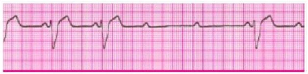 Exam ACLS: Question 7 - Image 1